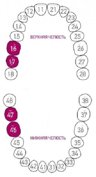 3